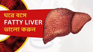 Non Alcoholic Fatty liver Home remedies [upl. by Nnadroj]