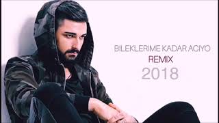 İdo Tatlıses  Bileklerime Kadar Acıyo Remix [upl. by Attenol395]