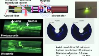 Photoacoustic tomography ultrasonically breaking through the optical diffusion limit [upl. by Anayet]