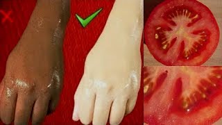 Surprenant  ajoutez ceci à la tomate pour blanchir la peau naturellement [upl. by Elie]