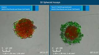 Monitoring and Quantifying 3D Tumor Spheroid Drug Cytotox by RTCA eSight Live Cell Analysis System [upl. by Okika]