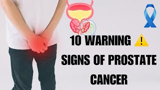 Dont Ignore These Prostate Cancer Symptoms [upl. by Haynes]