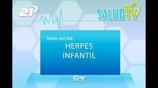 Salud TV  07062017  Herpes infantil [upl. by Nibla638]