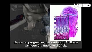 Patología del Sistema Osteoarticular  Parte 8 Osteocondrosis [upl. by Nerrej836]