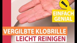 Vergilbte Klobrille leicht reinigen Toilettensitz von gelb nach weiß [upl. by Hermann]