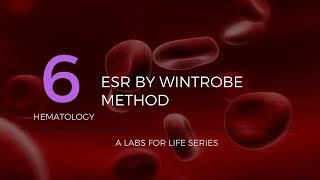 ESR by Wintrobe Method [upl. by Llenrep31]