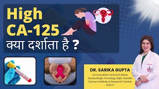 High CA125 क्या दर्शाता है  डॉसारिका गुप्ता [upl. by Arde]