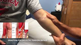 Graston Technique for Bicipital Tendon Repair [upl. by Grodin184]