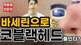 바세린으로 코 블랙헤드를 줄일수 있을까요 피부과전문의 피부심 [upl. by Annuaerb]