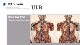 Pathologie médicale et chirurgicale  « Situs inversus »  par Darius Ahmadian [upl. by Rola391]