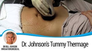 The Doctors  Dr Johnsons Tummy Thermage [upl. by Aeriel]