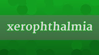 XEROPHTHALMIA pronunciation • How to pronounce XEROPHTHALMIA [upl. by Nylodam]