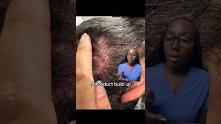 10 Causes of ITCHY Scalp [upl. by Llenad]