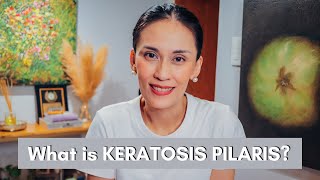 What is Keratosis Pilaris and how to Treat it  Dr Gaile RobredoVitas [upl. by Nike]