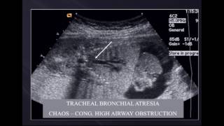 Examination of the Fetal Heart with Ultrasound by John P McGahan MD [upl. by Alano397]