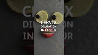 Cervical dilation [upl. by Shelah110]