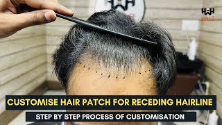 Hairline Receding solution  Customise Frontline hair patch  Hair wig house [upl. by Llenyar]