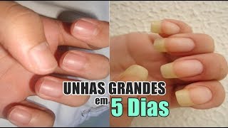 Como Fazer as unhas Crescerem em 5 dias [upl. by Wootten]