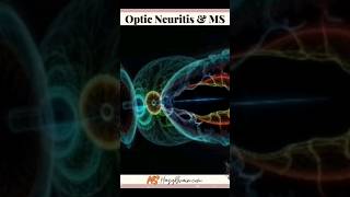 How To Recognize Optic Neuritis And MS [upl. by Desimone]