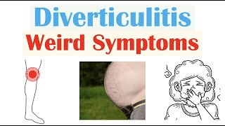 Weird Symptoms of Diverticulitis  Atypical Clinical Features of Diverticulitis [upl. by Britta]