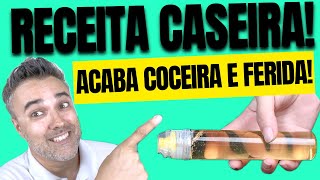 RECEITA CASEIRA acaba ✅COCEIRA ✅FERIDA ✅Dermatite [upl. by Datha]