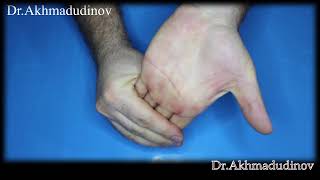 Treatment of joints with arthrosis of the hands [upl. by Atnoek]