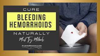 How to Stop Bleeding Hemorrhoids Naturally and Prevent Reoccurrence [upl. by Ahseek183]