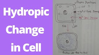 Hydropic change in Reversible cell injury  morphology of reversible cell injury  1year Bpharm [upl. by Darla]