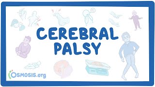 Cerebral palsy CP  causes symptoms diagnosis treatment pathology [upl. by Keane418]