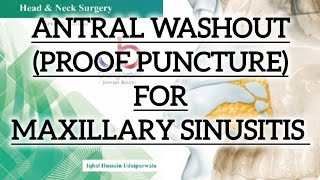 ANTRAL WASHOUT PROOF PUNCTURE TREATMENT OF MAXILLARY SINUSITIS [upl. by Daraj847]