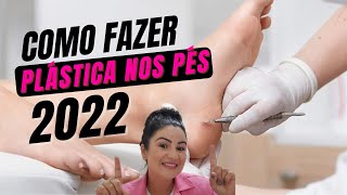 Aula 02 Como Fazer Plástica nos Pés Passo a Passo Simples e Fácil  Plástica dos Pés [upl. by Faxen]