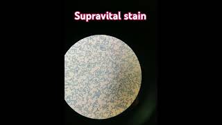 Supra vital stain  For reticulocyte count 💕 [upl. by Atlas]