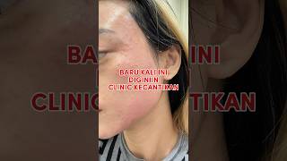 INSTA GLOW SERUM MICRO INJECTIONS FLECKS BLOCKER by ZAP CLINIC [upl. by Laura]