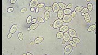Activité B21 observation microscopique des levures de boulanger [upl. by Soiritos221]