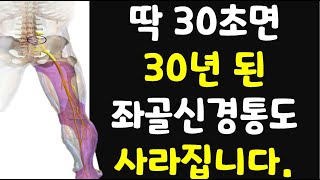 30초만에 방사통 일명 좌골신경통 즉시 없애주는 기가 막히는 운동 [upl. by Ayit115]