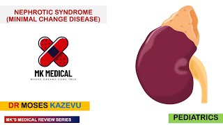 Nephrotic Syndrome Minimal Change Disease [upl. by Sandye]