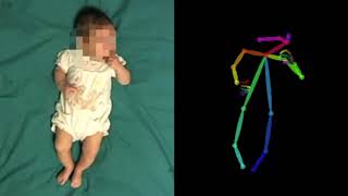 Pose estimation of infants spontaneous movements [upl. by Aicad435]