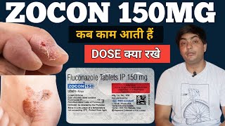 zocon 150  zocon 150 is used for in hindi  zocon 150 tablet  zocon 150 fluconazole [upl. by Harim753]