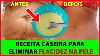 RECEITA CASEIRA PARA ELIMINAR FLACIDEZ DO CORPO  EM 7 DIAS VOCÊ VAI VER A DIFERENÇA [upl. by Anibor]