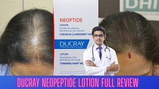 DUCRAY NEOPEPTIDE ANTI HAIRFALL LOTION REVIEW  बालो का झड़ना पहले दिन से गायब 🧑‍👨‍🦲🧑‍👨‍🦲🧑🧑‍ [upl. by Risteau104]