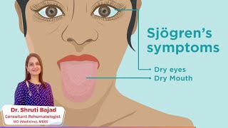 Sjogrens Syndrome  Dr Shruti Bajad  skincare arthritis [upl. by Lammond]