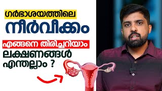 ഗർഭാശയത്തിൽ നീർവീക്കം ഉണ്ടോ  എങ്ങനെ തിരിച്ചറിയാം  ലക്ഷണങ്ങൾ എന്തല്ലാം [upl. by Eppesuig858]