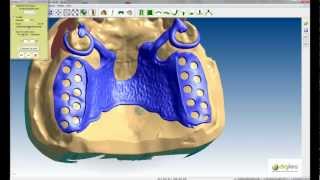 Logiciel CAO DIGISTELL pour la création de châssis squeletté pour prothésistes dentaires Part 2 [upl. by Kent]
