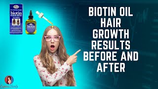 ✅😍Biotin oil for hair growth  Before vs After  Is Biotin Good for Hair Growth💇‍♂️ [upl. by Eybba]