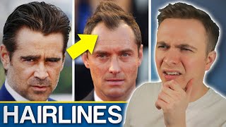 Widows Peak VS Receding Hairline  Should You Be Worried [upl. by Labannah23]