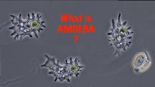 What is Amoeba [upl. by Eiraminot639]