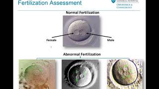 Embryo Selection and Transfer  Mass General Fertility Focus Webinar [upl. by Auburn48]