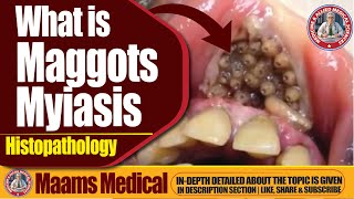 What is Maggots Myiasis Histopathology  Causes Symptoms and Treatment [upl. by Hobey]