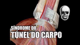 SÍNDROME do TÚNEL do CARPO e o NERVO MEDIANO  Anatomia Humana [upl. by Laumas966]