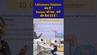 Lithotomy Position क्या है  Patient को कब क्यों और कैसे देते हैं reels medicalstudent shorts [upl. by Eadmund]